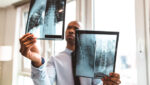 See a Doctor within 24 to 48 hours of any Motor Vehicle Collision