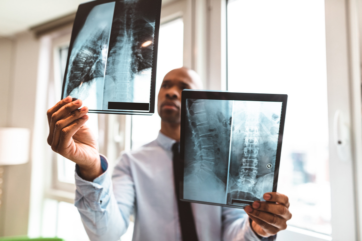 See a Doctor within 24 to 48 hours of any Motor Vehicle Collision