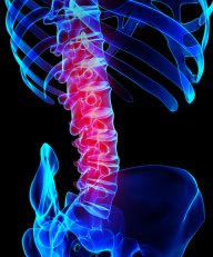 Lower Back Injury Attorney Xray